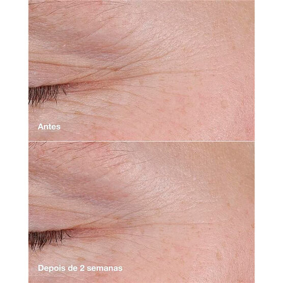 Balm Pro Idade Clinique Smart&trade; Retin&oacute;ide